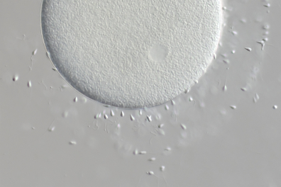 Fécondation chez l'Oursin - détail montrant les spermatozoïdes (Sphaerechinus granularis) x160